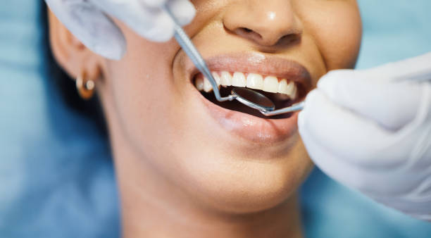 Best Emergency Tooth Extraction in Taylor, PA