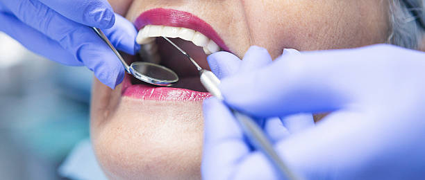 Best Emergency Root Canal Treatment in Taylor, PA